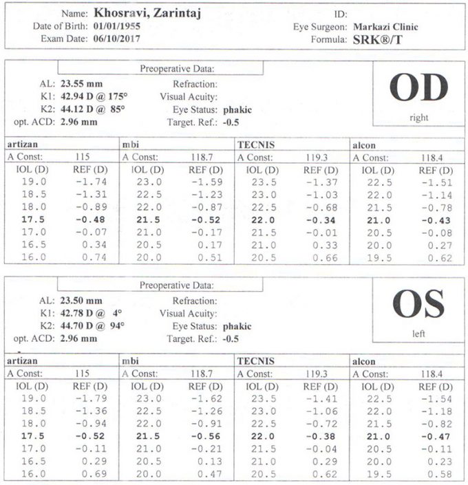 IOL Master | کلینیک چشمخانه