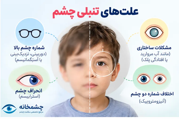 تنبلی چشم در کودکان و علائم آمبلیوپی