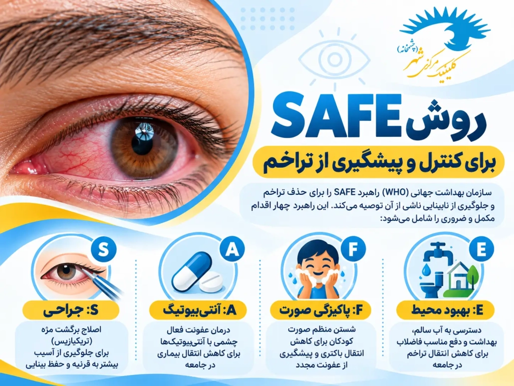 روش SAFE برای درمان، کنترل و پیشگیری از تراخم