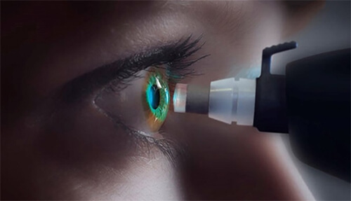 درمان فشار چشم توسط چشم پزشک