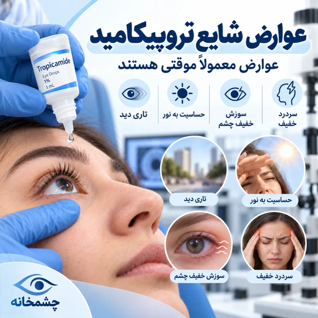 عوارض شایع قطره چشم تروپیکامید شامل تاری دید و حساسیت به نور