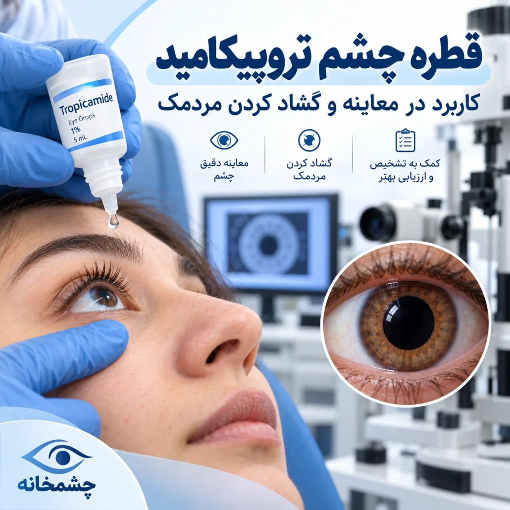قطره چشم تروپیکامید برای گشاد کردن مردمک و معاینه دقیق چشم