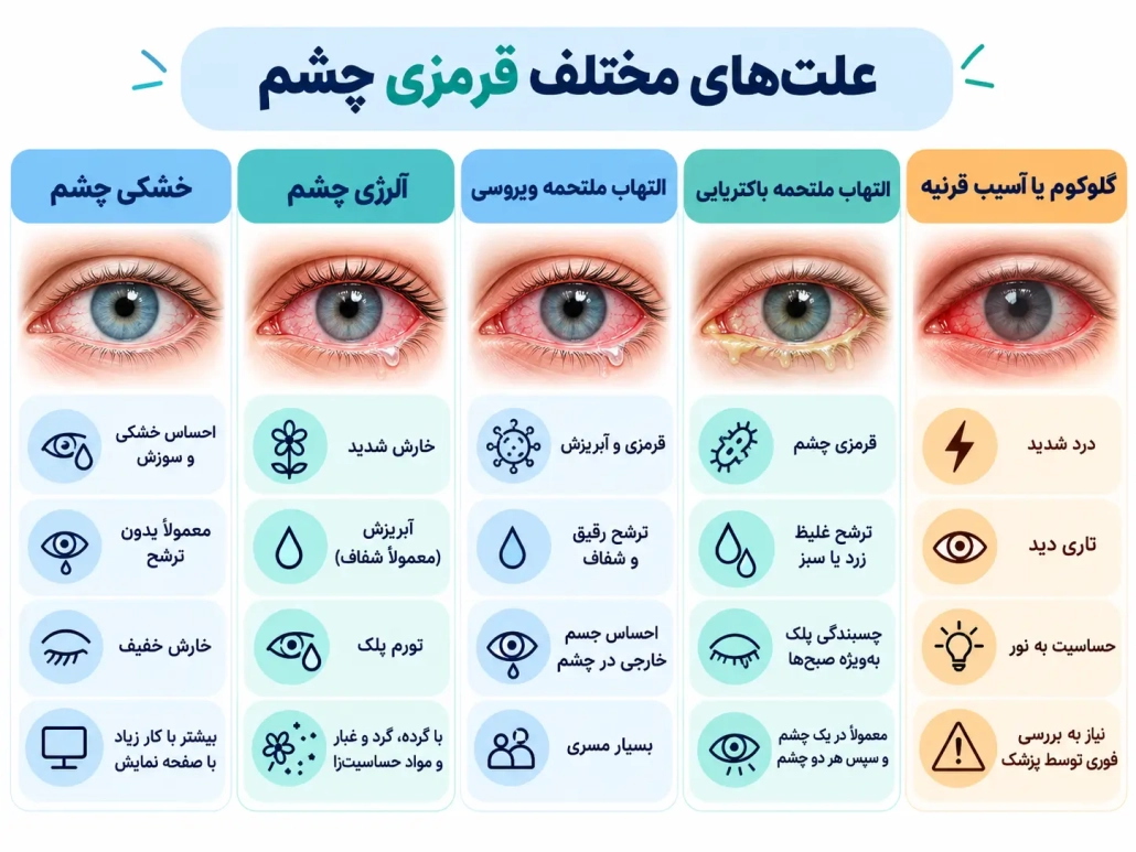 مقایسه علت_های قرمزی چشم شامل خشکی، آلرژی، عفونت و گلوکوم 