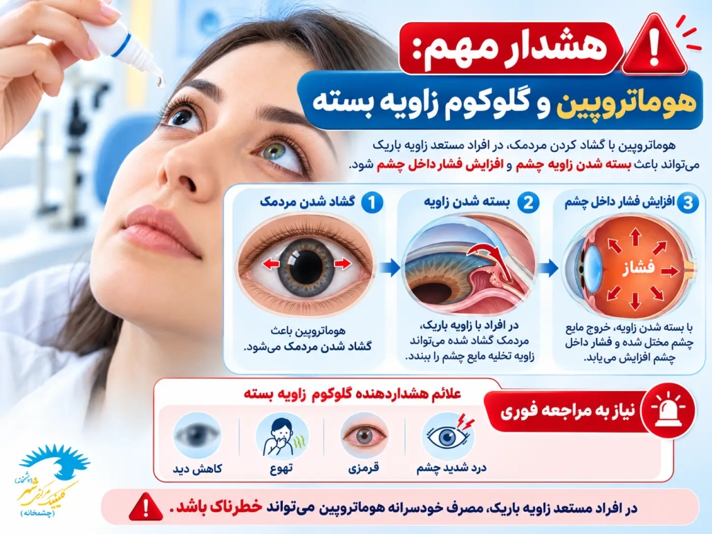 هشدار مصرف هوماتروپین در افراد مستعد گلوکوم زاویه بسته