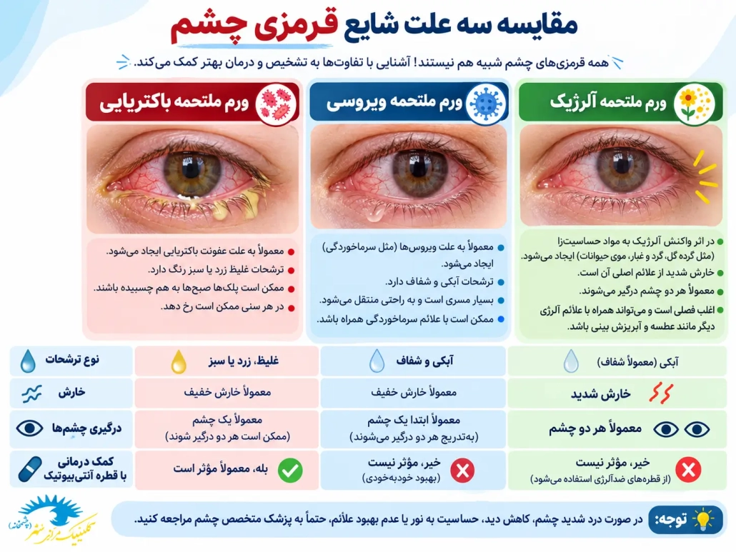 تفاوت التهاب ملتحمه باکتریایی ویروسی و آلرژیک