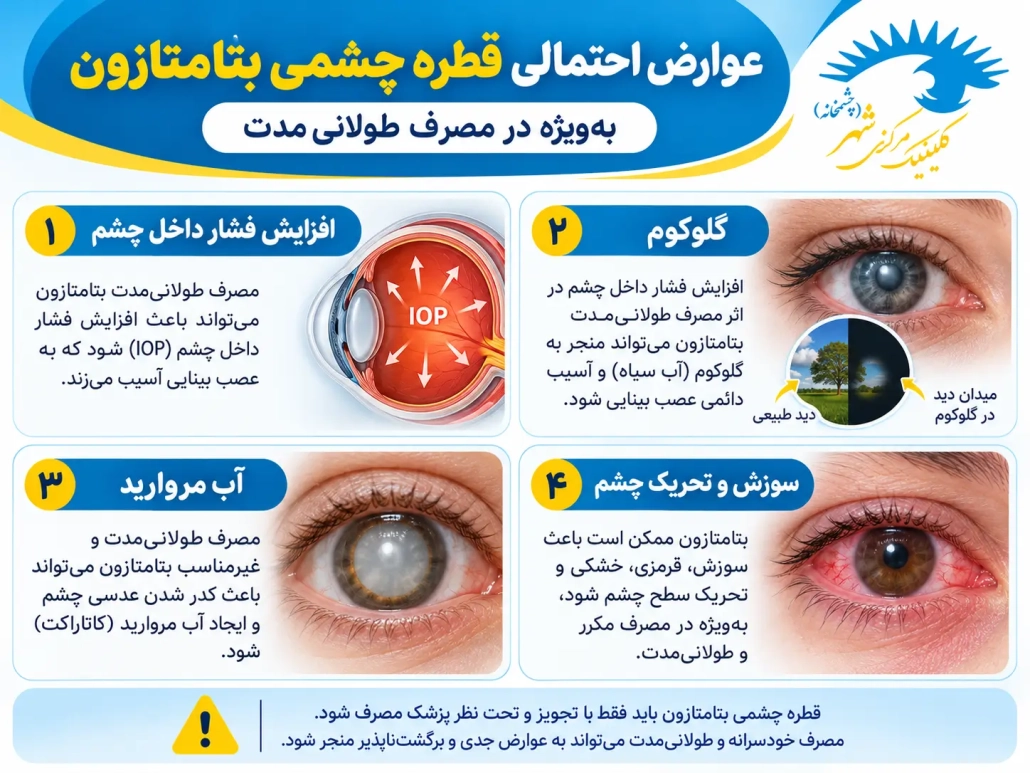 عوارض مصرف طولانی قطره بتامتازون شامل افزایش فشار چشم و کاتاراکت