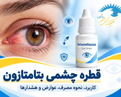 قطره چشمی بتامتازون برای کاهش التهاب و قرمزی چشم