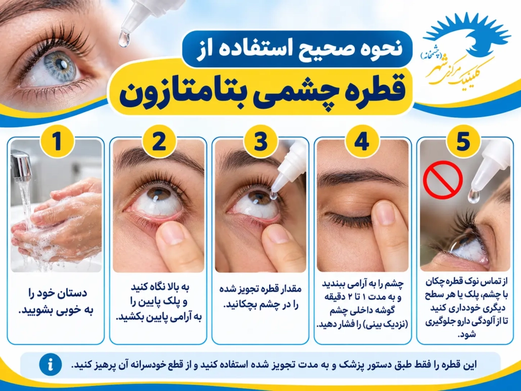 نحوه صحیح استفاده از قطره چشمی بتامتازون