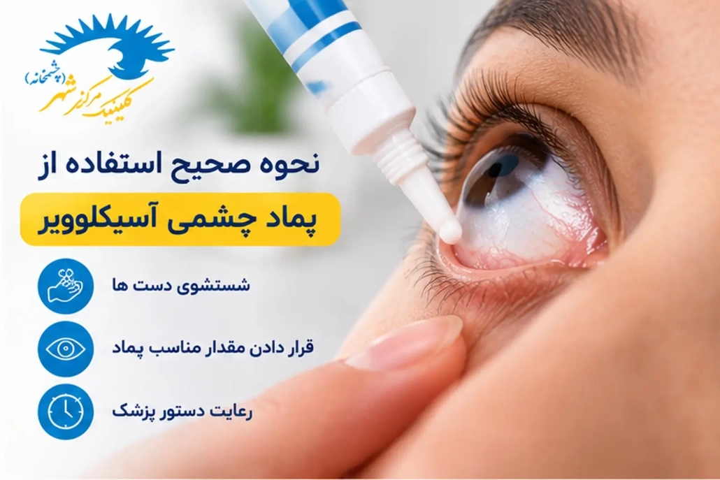 نحوه صحیح استفاده از پماد چشمی آسیکلوویر