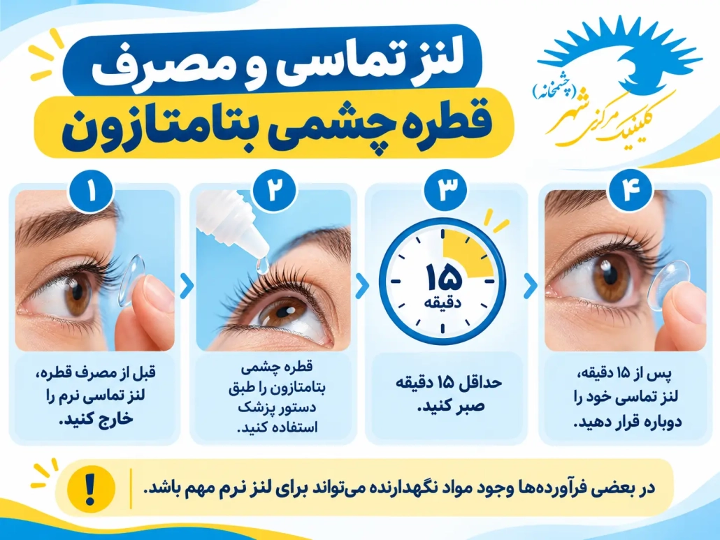 نکات استفاده از لنز تماسی هنگام مصرف قطره چشمی بتامتازون