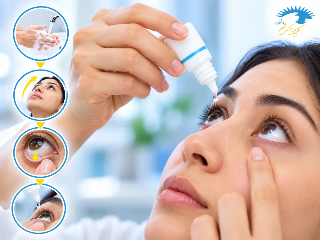 روش صحیح استفاده از قطره چشم تیمولول و ریختن قطره در چشم