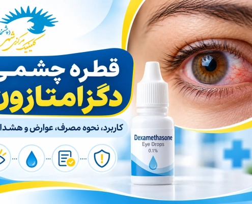 قطره چشمی دگزامتازون برای کاهش التهاب و قرمزی چشم