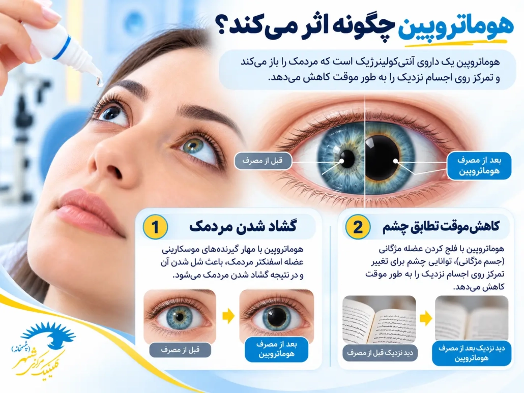 نحوه اثر قطره هوماتروپین در گشاد شدن مردمک و کاهش تطابق چشم