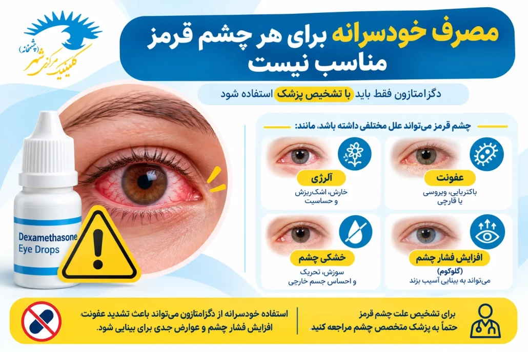 هشدار مصرف خودسرانه دگزامتازون برای چشم قرمز و عفونت چشمی